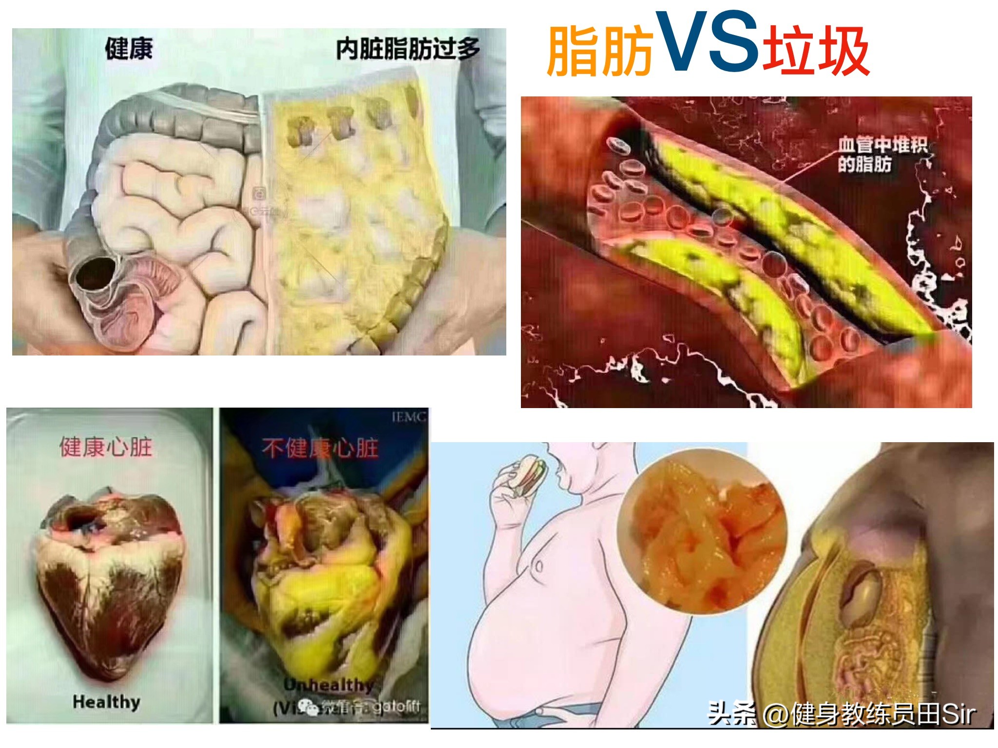 脂肪消失的6个信号，脂肪消失的6个信号有哪些