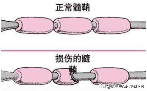 检验睡没睡够的标准，没睡够的表现