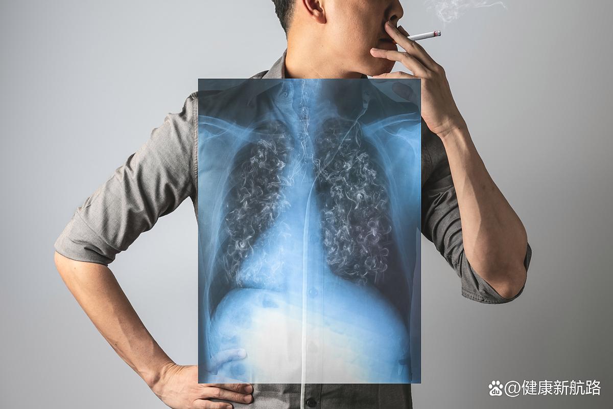 不抽烟的女性得肺癌，不抽烟的女性患肺癌的主要原因