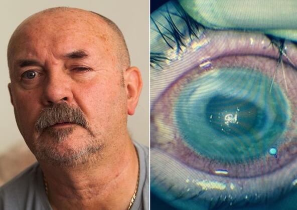 戴隐形洗澡染寄生虫，戴隐形洗澡染寄生虫会怎么样