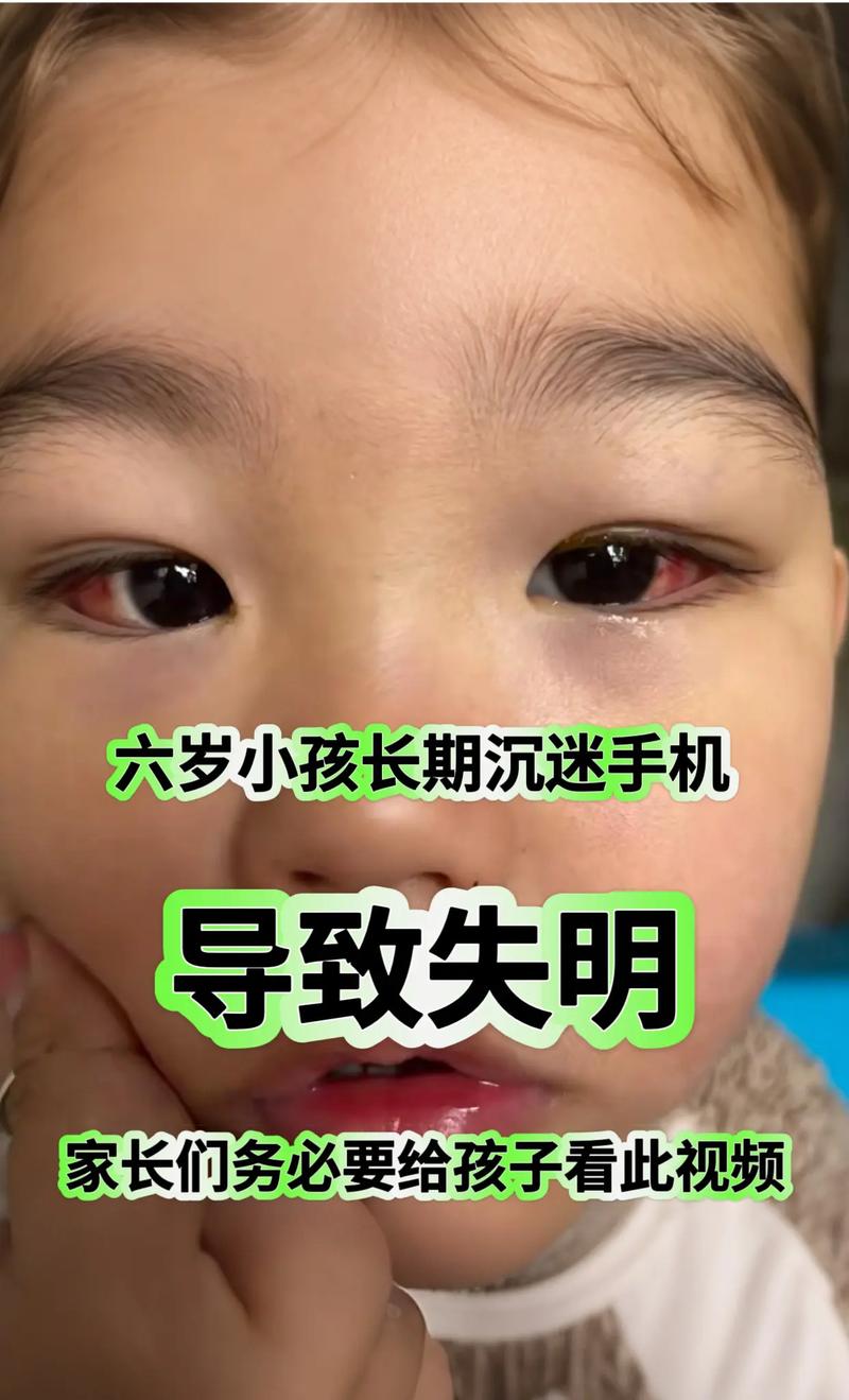 3岁下不接触电子屏，小孩不能看电子屏幕