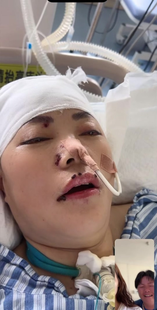 演员因脑出血去世，死于脑出血的明星