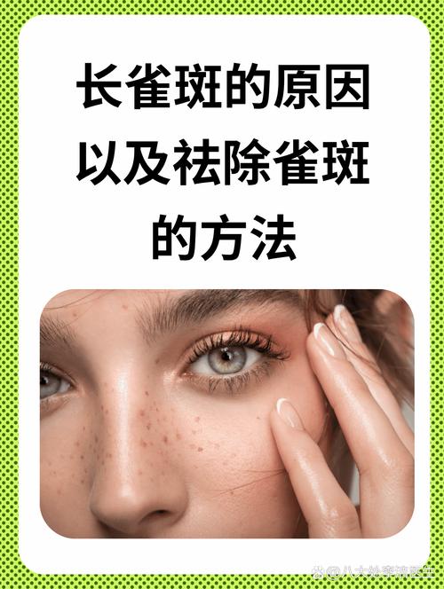 太阳脸上长雀斑，太阳脸上长雀斑:个头不小