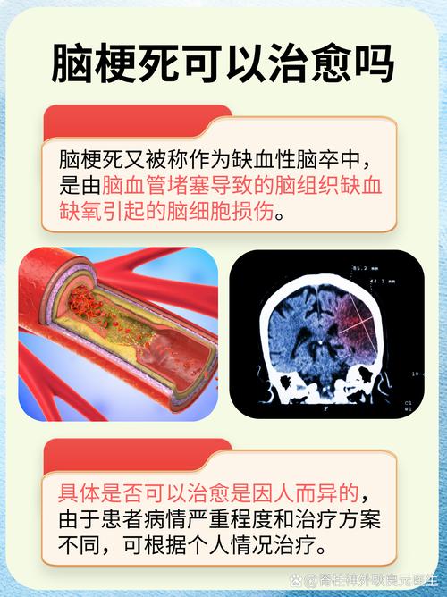 男子3年内2次脑梗死，男子3年内2次脑梗死能活多久