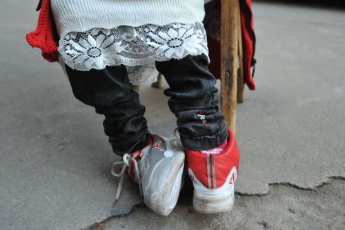 福建发现1例镜面人，福建发现1例镜面人是真的吗