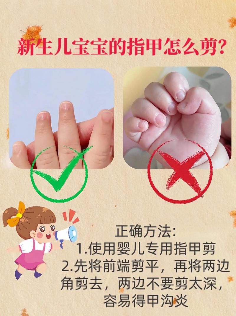 新生儿疑被剪断手指，新生儿被剪到手怎么办