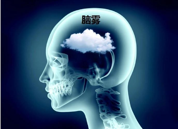 短视频刷多了会脑雾，短视频刷多了会脑雾吗